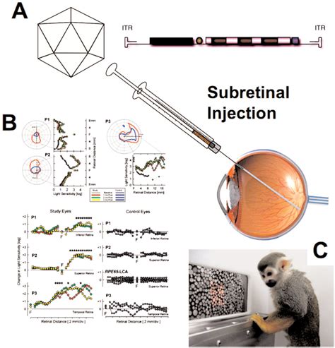 Two Decades of Clinical Gene Therapy – Success Is Finally 